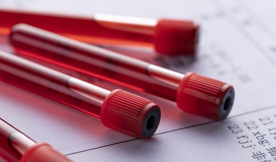 试管婴儿抽血检查注意事项：什么时候采血、是否需要空腹