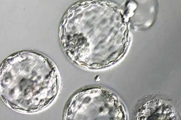 美国EFC生殖中心：三代试管婴儿优胚着床失败解析