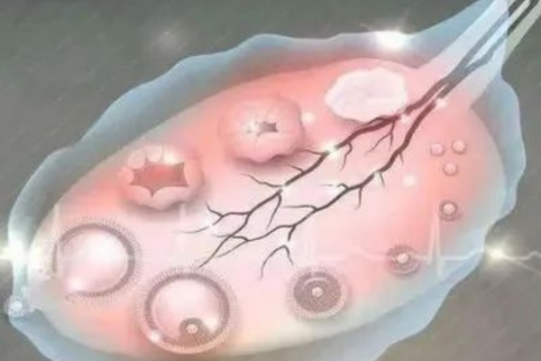 泰国千禧生殖中心：卵泡成熟不了？原因和改善方法看这里！