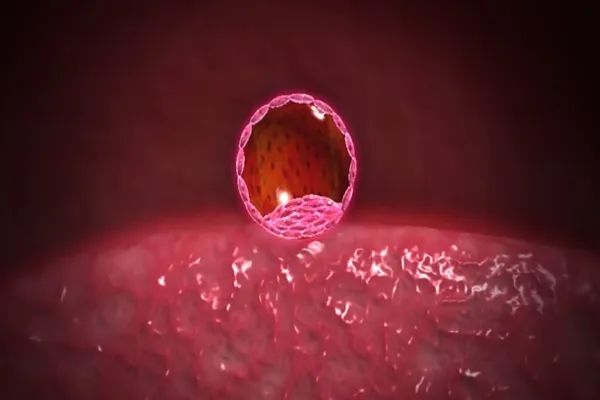 泰国千禧生殖中心：胚胎移植后要警惕这些关键症状