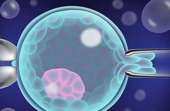 山东大学附属生殖医院试管婴儿流程解析