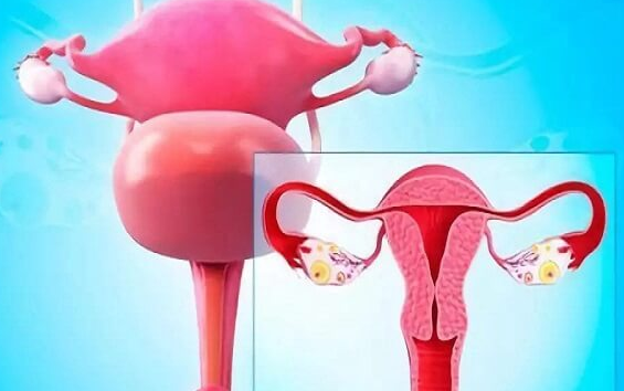 子宫内膜异位症试管受孕率解析：排卵并非唯一关键