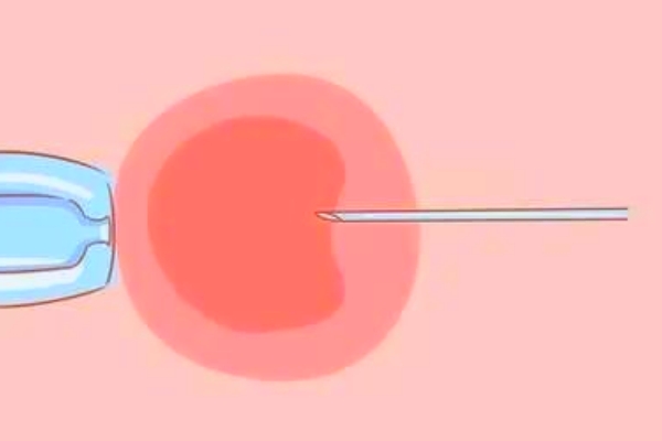 赴吉试管婴儿“火爆”，竟是这些原因！