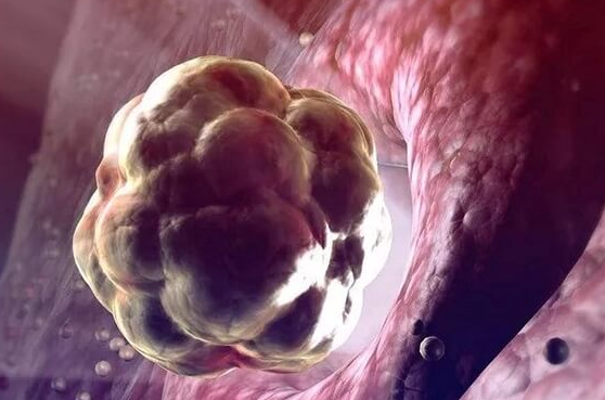 试管婴儿胚胎退化：多因素交织下的生育挑战