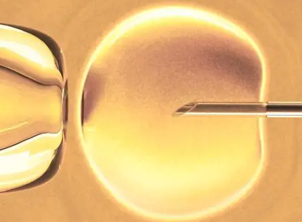 短方案促排后打HCG：调理子宫内膜，助力胚胎着床