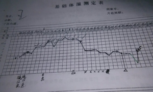 全面汇总备孕常见测排卵方法，精准规划好孕之路