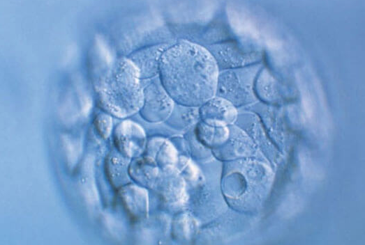 40+月经正常女性，卵子质量由何定？