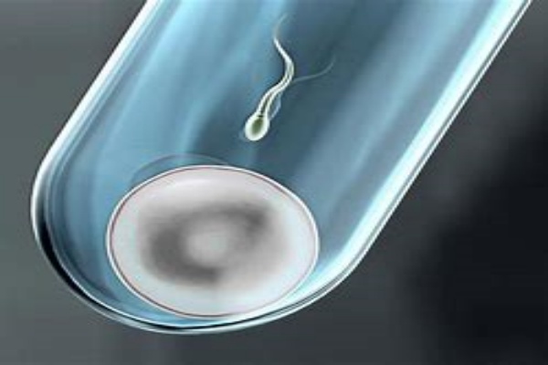 格鲁吉亚Universe：格鲁吉亚第三方辅助生殖指南-男性助孕的选择与优势全解析