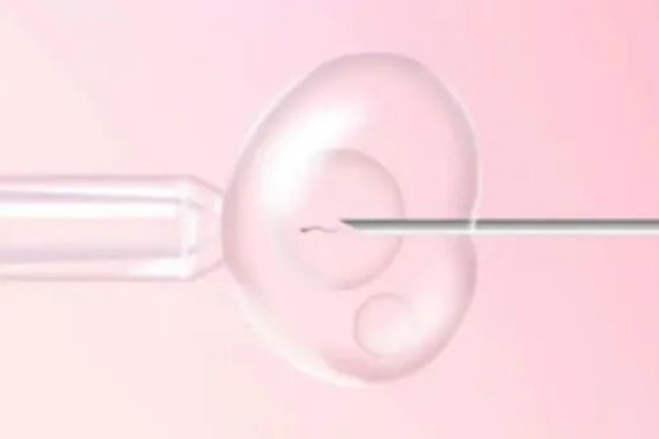 泰国千禧生殖中心：试管婴儿技术的优选之地