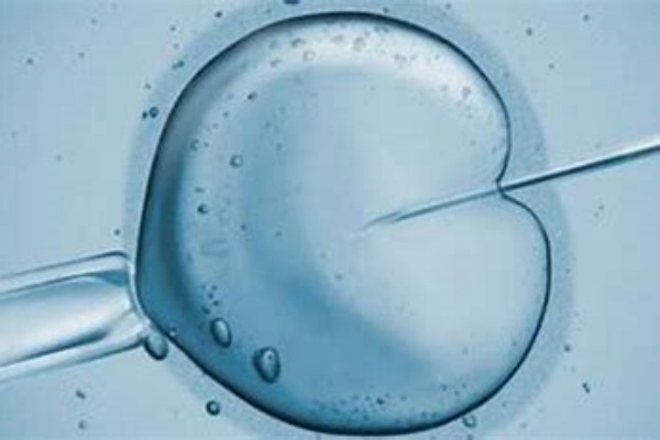 试管婴儿全过程指南：关键注意事项与成功策略