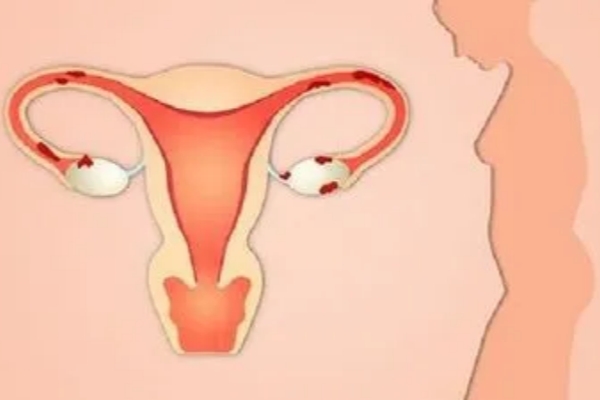 想做试管婴儿，警惕这六种疾病！