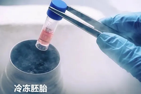 格鲁吉亚GGRC生殖中心：详解试管婴儿胚胎冷冻以及解冻复苏流程