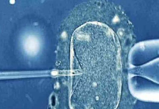 卵泡不破别焦虑，科学食疗助排卵