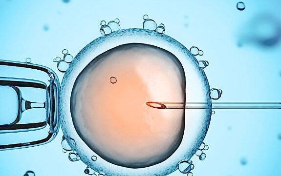 高龄夫妻赴格鲁吉亚试管婴儿注意事项