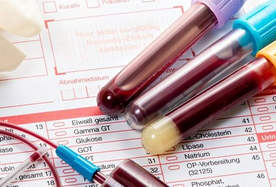 试管移植后如何判断有没有着床？