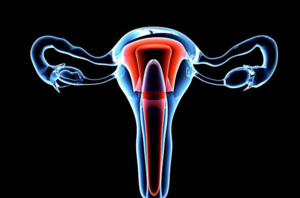 宫腔粘连对女性生育的影响：不孕、月经不调等问题解析