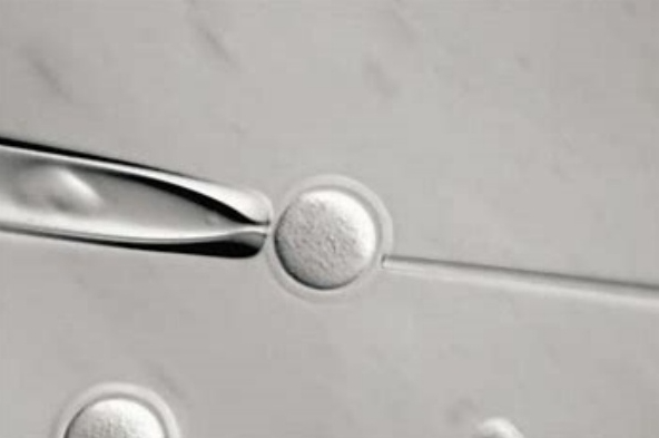 杭州三代试管婴儿流程详解