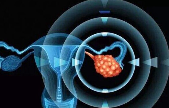 揭秘卵巢低反应：试管促排并非唯一“元凶”