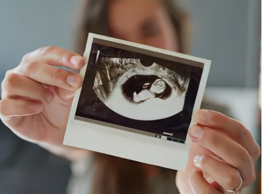 美国BHF生殖中心三代试管婴儿：人工周期与自然周期如何抉择？