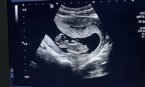 孕妇必知：增加胎儿氧气的有效方法，适当走动益处多