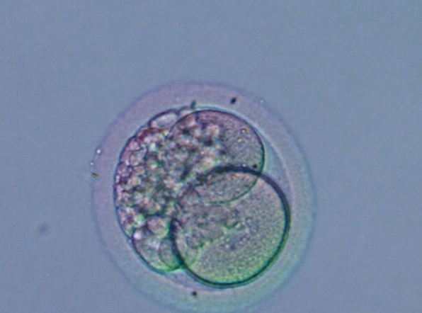 高龄女性到北京做试管婴儿的条件与注意事项