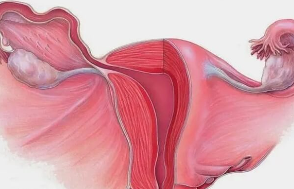 子宫畸形:试管婴儿路上的“隐形挑战”