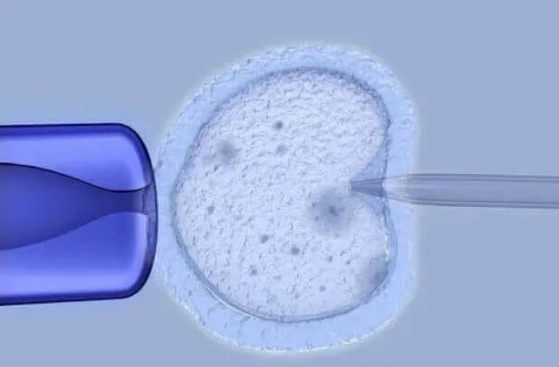 三代试管婴儿:科技之光下的利弊权衡