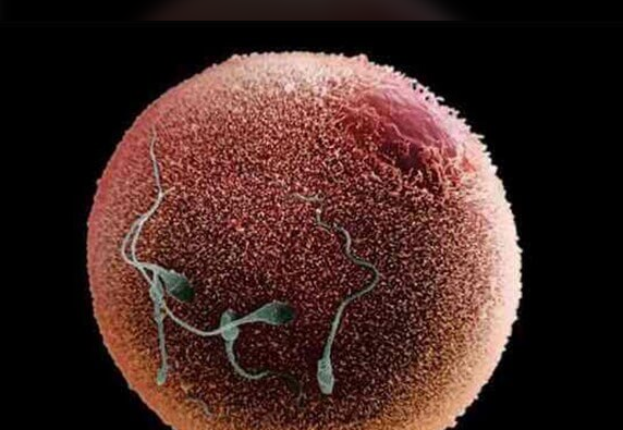 试管婴儿成功后多余胚胎的妥善归宿:冷冻存储成主流之选