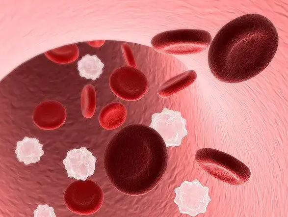 孕妇检查ABO溶血：两个关键时期务必按时筛查