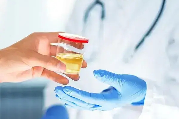 泰国千禧生殖中心：肾功能检查在试管婴儿中的关键作用