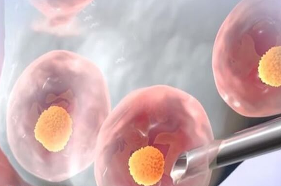 盘点格鲁吉亚试管囊胚移植的4大优势