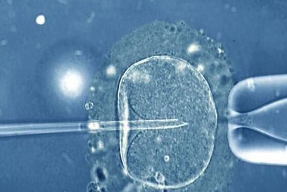 格鲁吉亚辅助生殖技术治疗为什么这么受欢迎全解析