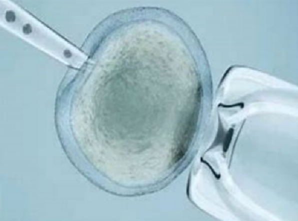 吉尔吉斯斯坦试管婴儿：法律宽松，服务便捷