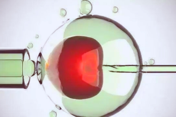 格鲁吉亚试管婴儿：性价比之选，助力家庭圆梦