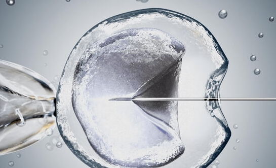 试管婴儿一代转二代的原因分析：除精卵不结合外的关键因素