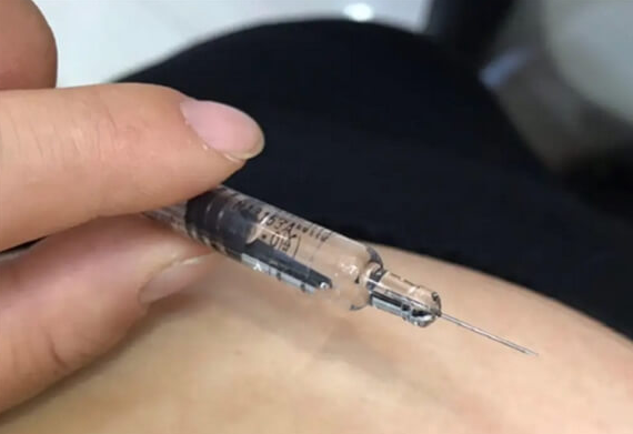 北京做试管婴儿取卵疼不疼？麻醉取卵能有效缓解疼痛感