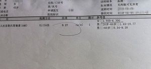 为什么不同医院每个月检查的amh值都不一样?