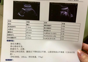 28-32周做的小排畸是不是普通b超？