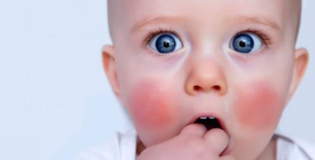发红、痒或流口水，都是4个月宝宝长牙发烧症状吗？