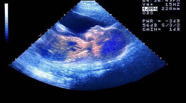 胎儿打嗝从多少周开始，持续几个月后都能感受到正不正常？
