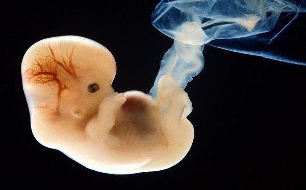 孕37周胎儿打嗝算不算胎动，两者之间的区别有哪些？