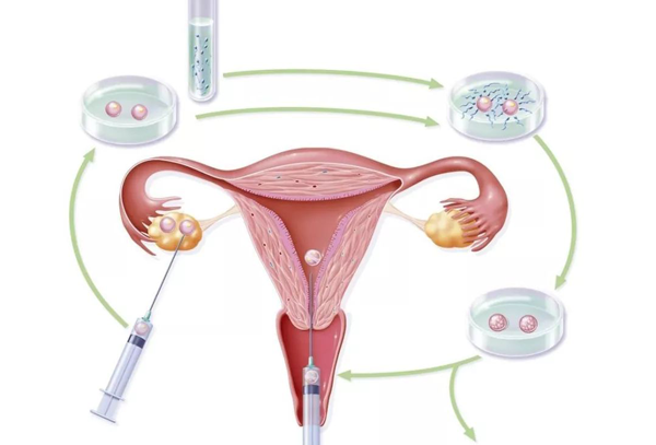 输卵管没有问题，促排卵一般几次能成功怀孕？