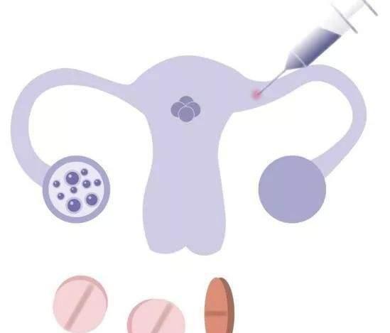 再谈试管婴儿促排卵，微促、大促、多重促排、黄体期...有何区别？