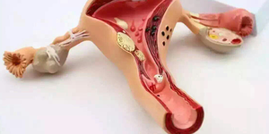 女性促黄体生成素高怎么调理效果比较好?