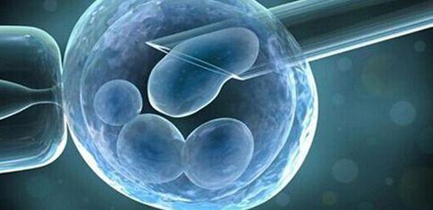 胚胎基因筛检是La Jolla试管婴儿的技术保证