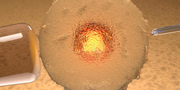 试管婴儿窦卵泡＞8,黄体期促排方案能否助孕多囊卵巢