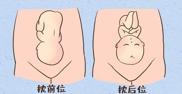 孕36周头部右枕后位能顺产吗？