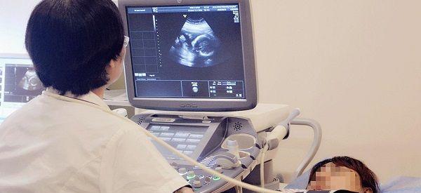 孕24周做四维彩超后医生问是不是二胎是什么暗示？