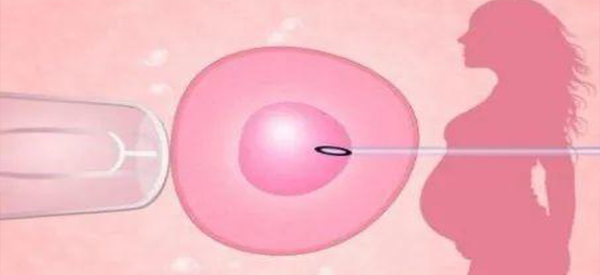 黄体期促排卵方案做试管婴儿的详细过程是什么？