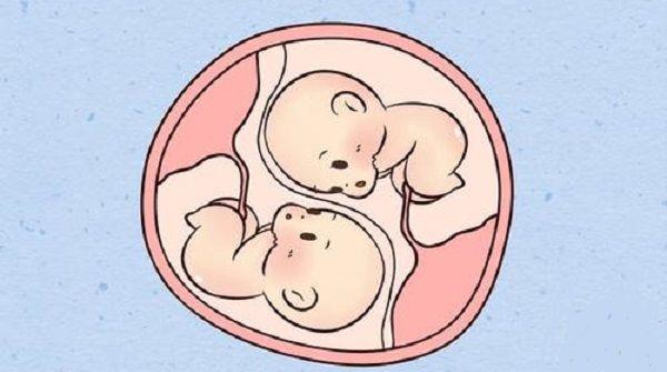 2个症状提示双胎一起停育，查明原因很重要